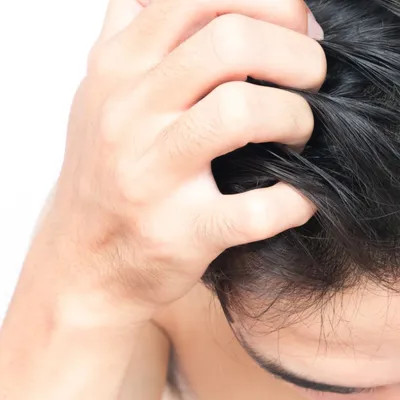 頭皮のかゆみ対策ができる男性用シャンプーおすすめランキング30選|ドラッグストアの市販品・薬用・40代向けも