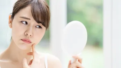 【2023年1月】ニキビ肌用化粧水のおすすめ人気ランキング35選!選び方のポイントも解説!