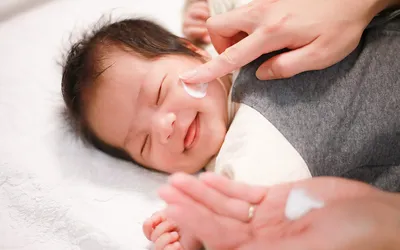 妊娠中の食事で赤ちゃんがアトピーになる?食生活と発症リスクの関係とは