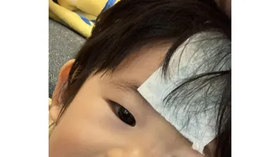 冷やしながら様子を観察。数時間後に症状が出ることもあるため、しばらく見守ります