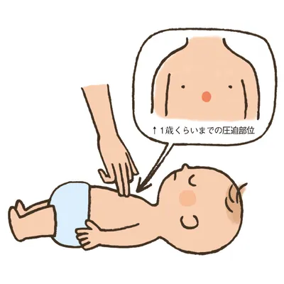 心配蘇生