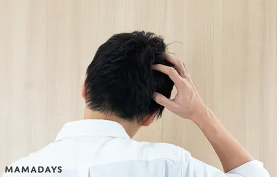 かゆみ・フケ対策シャンプーの3つの選び方