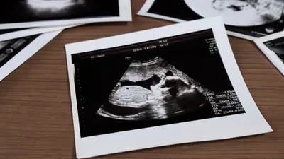 妊婦健診のエコー検査でわかる胎児の異常とは？時期別に解説