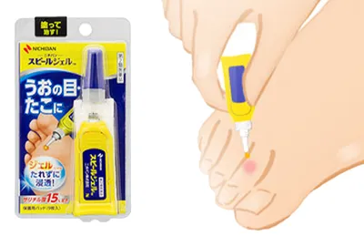 スピールジェル塗布画像①
