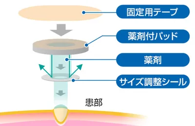 スピール膏ワンタッチEX貼付方法画像