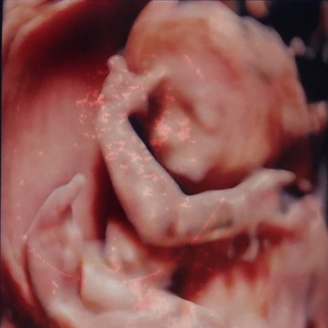 医師監修】エコー写真の見方がわからない！BPDやFLとは？用語の意味と時期ごとのチェックポイントを解説 | トモニテ