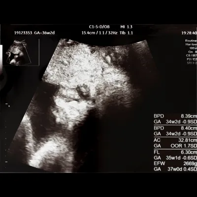 エコー写真の見方がわからない！専門用語の意味や時期ごとのチェックポイントを解説！