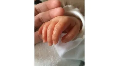 赤ちゃんの爪切りってどうしたらいい？